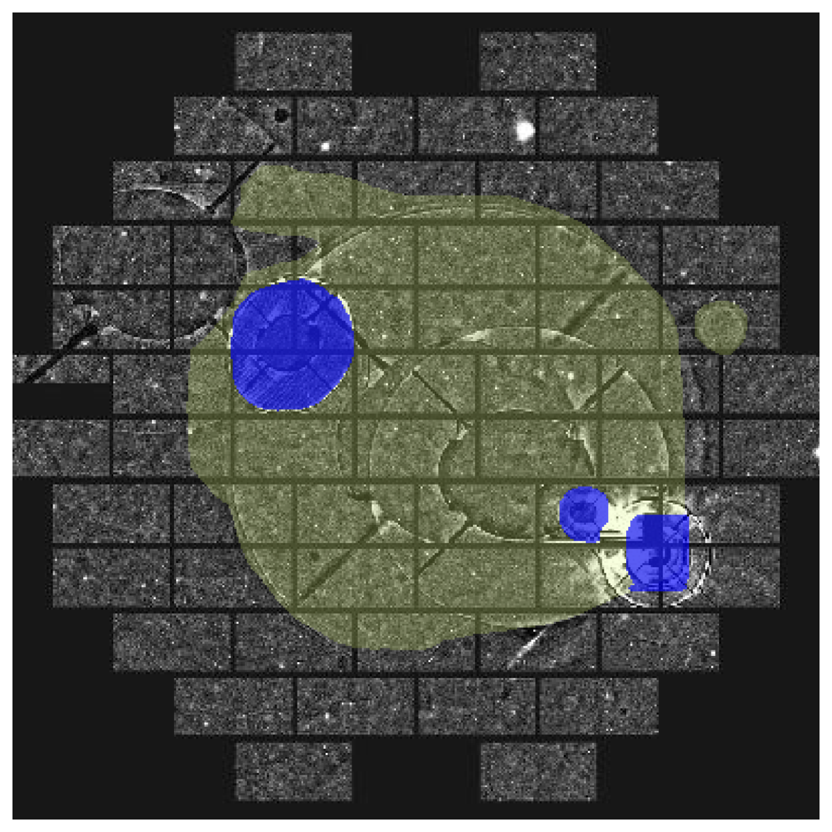 Refer to caption